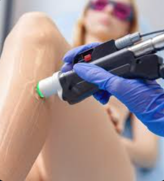Laser Hair Removal by Motus - 6 Session Package